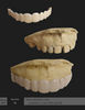 cosmetic teeth