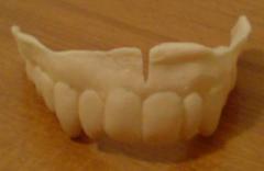 Dentiera_Grezza