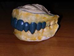 Dentiera_Modello