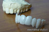 Nome del file=fx_protesi_dentali_3.jpg
Dimensione del file=39KiB
Dimensioni=400x260
Aggiunta il=Feb 18, 2010 fx_protesi_dentali_3.jpg